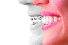 invisalign-provider-black-lg