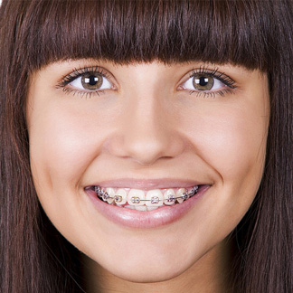 Surgical Orthodontics